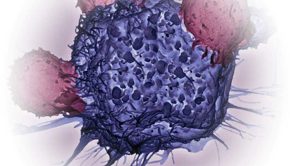 Imagen microscópica de tejido anormal.