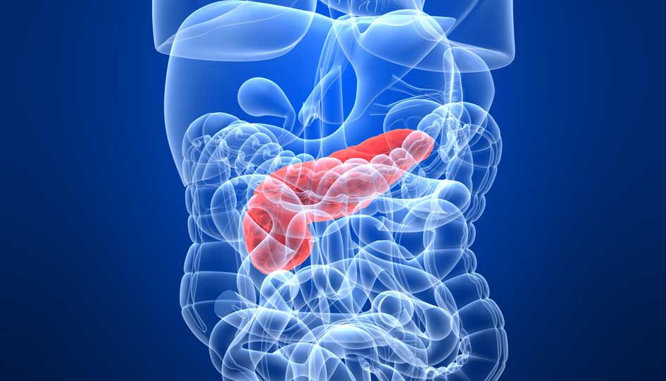 Simulación computadorizada de la detección del cáncer de páncreas.