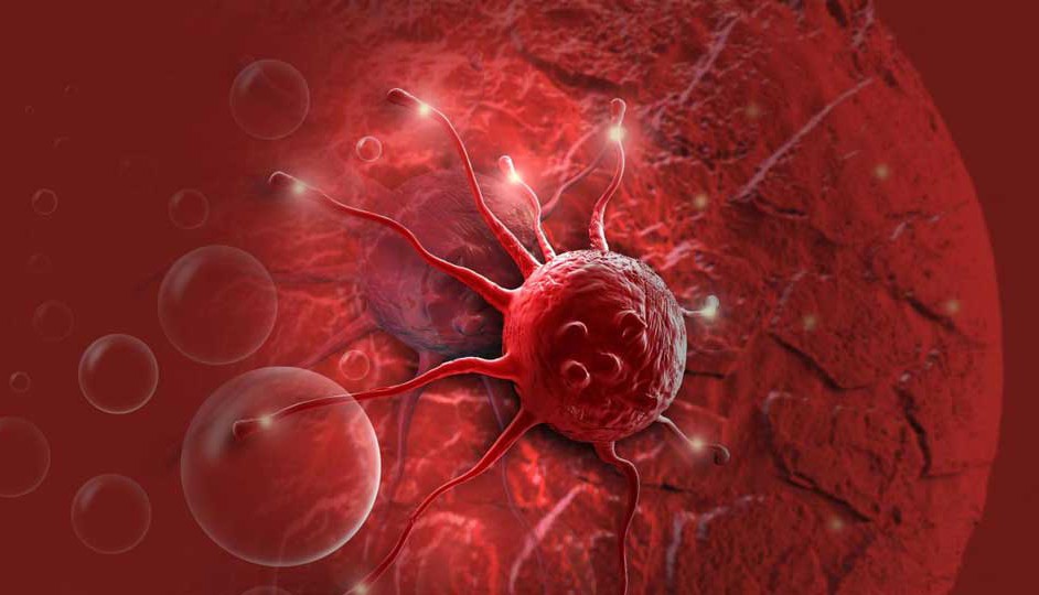 Imagen dramatizada del desarrollo del cáncer.
