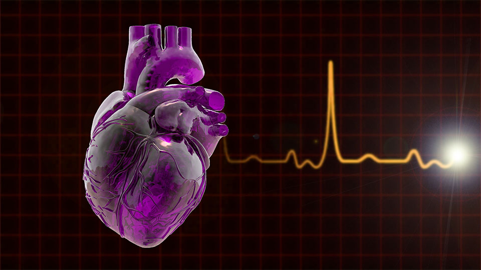 Unidad de Insuficiencia Cardíaca e Hipertensión Arterial Pulmonar.